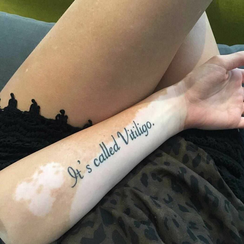 Peuton tatouer sur tous les types de peaux ? On vous dit tout.